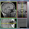 Logo for Volume Slicer Applet - MR Scan of a human head